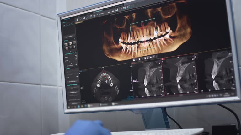 Dental X-Rays and Imaging in Parma, ID